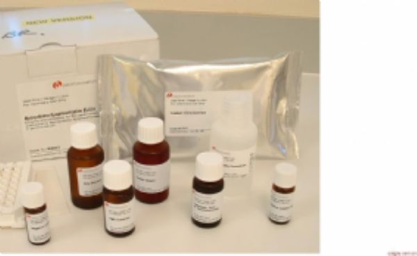 人血清淀粉样蛋白A(SAA)ELISA试剂盒