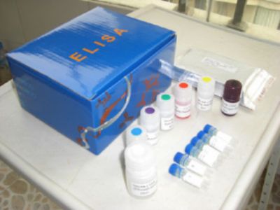 人甲基化酶(Methylase)ELISA试剂盒 规格