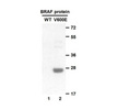 Anti BRaf(V600E) Mouse Monoclonal Antibody/现货