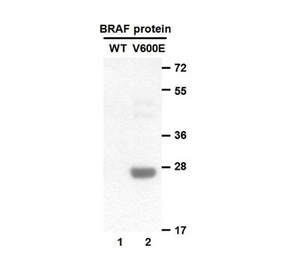 Anti BRaf(V600E) Mouse Monoclonal Antibody/现货