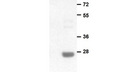 Anti BRaf(V600E) Mouse Monoclonal Antibody/现货