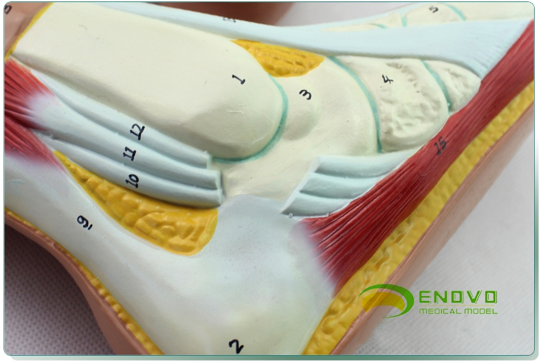 enovo颐诺医学正常足扁平足弓形足高弓足模型脚足弓模型运动系统